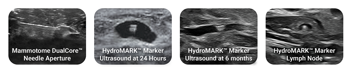 ultrasound images.png