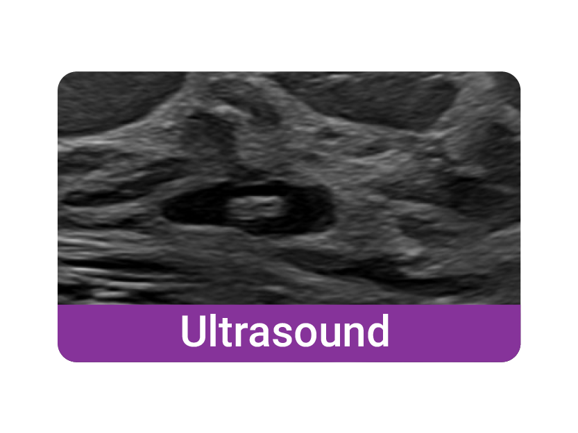 ultrasound